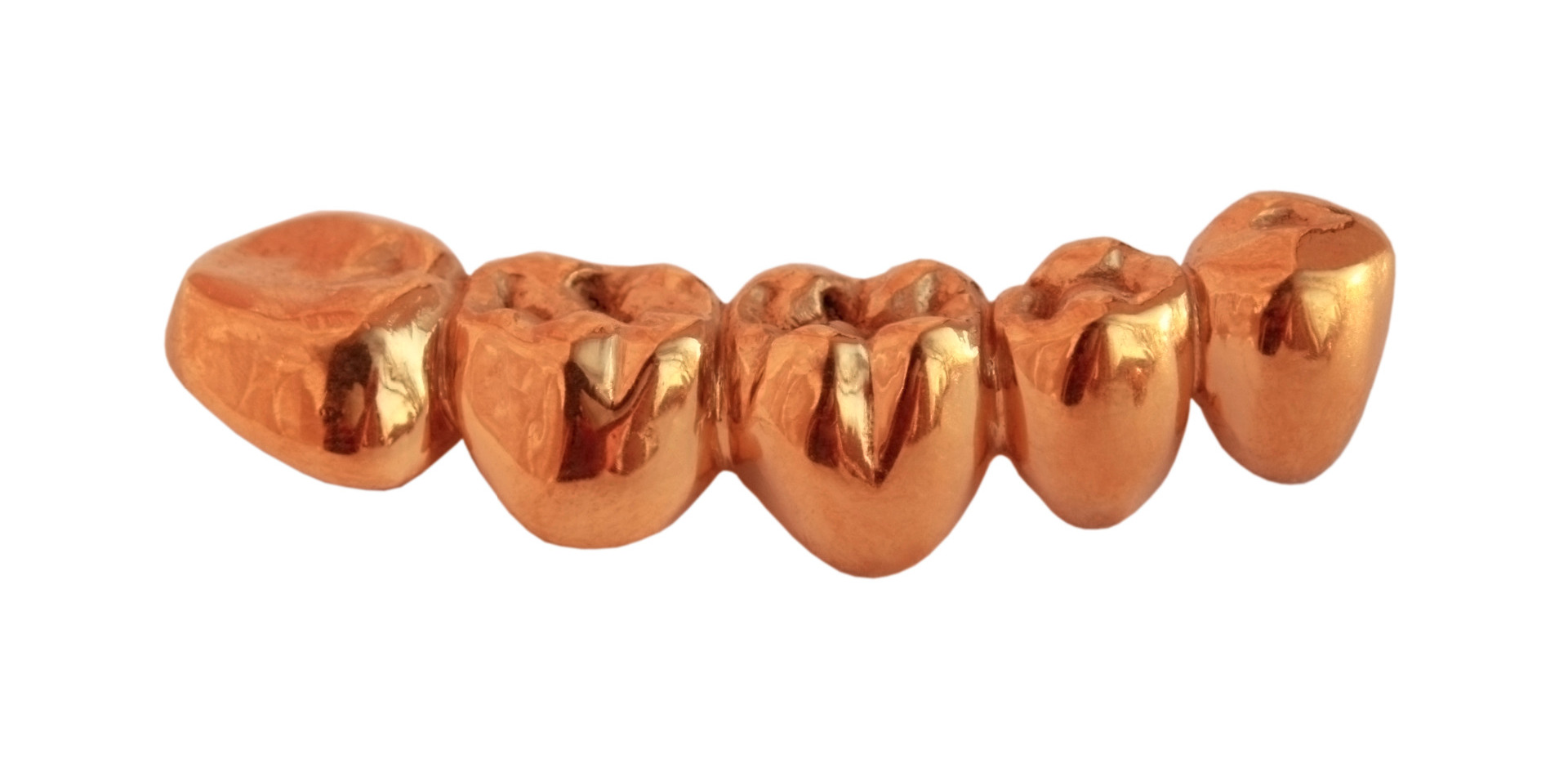Gold dental crowns, gold dental work